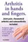 Arthritis in Hands and Arthritis in Fingers. Rheumatoid Arthritis and Osteoarthritis Included. Symptoms, Signs, Treatment, Diet, How to Prevent & Exer