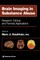 Brain Imaging in Substance Abuse
