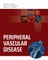 Peripheral Vascular Disease