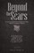 Beyond the Scars