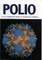 Polio
