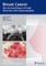 Tabar, L: Breast Cancer - The Art and Science of Early Detec