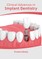 Clinical Advances in Implant Dentistry