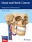Head and Neck Cancer