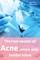 The true causes of Acne, which only Insider know