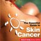 Skin Cancer