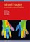 Infrared Imaging