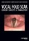 Vocal Fold Scar