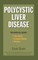 Polycystic Liver Disease