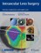 Intraocular Lens Surgery