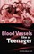 Blood Vessels like a Teenager