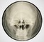 Coates, S., Bone Music