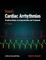 Cardiac Arrhythmias 8e