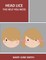 Head Lice