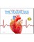 The 12-Lead ECG in Acute Coronary Syndromes