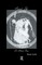 Sexual Life in Ancient Greece