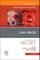 Lung Cancer, an Issue of Hematology/Oncology Clinics of North America