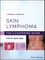 Skin Lymphoma