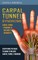 Carpal Tunnel Syndrome