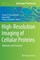 High-Resolution Imaging of Cellular Proteins