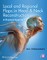 Local and Regional Flaps in Head and Neck Reconstruction