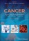 Cancer 2e P