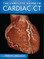Complete GD to Cardiac CT (Pb)