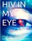 HIV in my Eye