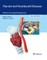Thyroid and Parathyroid Diseases