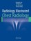 Radiology Illustrated: Chest Radiology