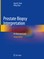 Prostate Biopsy Interpretation