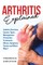 Arthritis Explained