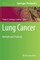 Lung Cancer