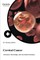 Cervical Cancer