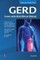 Gerd