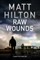 Raw Wounds