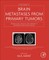 Brain Metastases from Primary Tumors, Volume 3