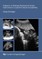 Exposure to Prenatal Psychosocial Stress: