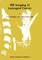 MR Imaging of Laryngeal Cancer