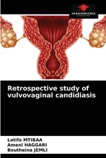 Retrospective study of vulvovaginal candidiasis Retrospective study of vulvovaginal candidiasis