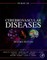 Primer on Cerebrovascular Diseases