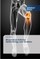 Rheumatoid Arthritis