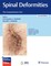Dewald, C: Spinal Deformities