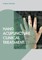 Hand Acupuncture