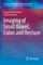 Imaging of Small Bowel, Colon and Rectum