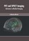 Pet and Spect Imaging: Advances in Medical Imaging