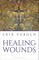 Healing Wounds