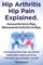 Hip Arthritis, Hip Pain Explained. Osteoarthritis in Hips, Rheumatoid Arthritis in Hips. Including Hip Arthritis Surgery, Hip Flexor Pain, Exercises,