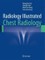 Radiology Illustrated: Chest Radiology