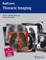 Thoracic Imaging
